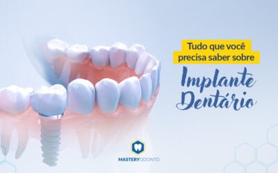 Tudo o que você precisa saber sobre o implante dentário.